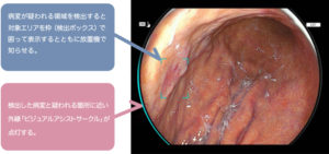 マイクリニック大久保静岡院の内視鏡検査の大腸カメラAI補助診断装置の様子