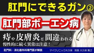 YouTube：【肛門ボーエン病】湿疹や痔と間違われやすい稀な皮膚がん